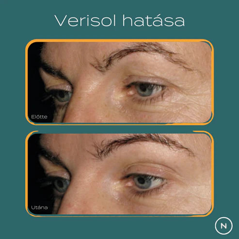 verisol kollagén hatása